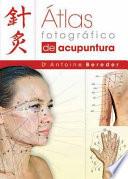 Libro Atlas Fotografico de Acupuntura